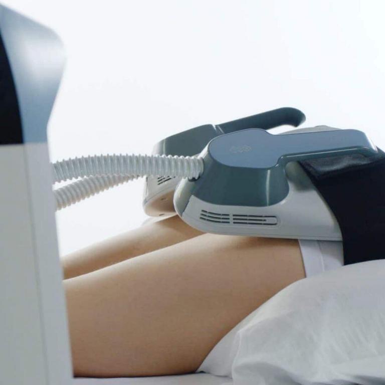 Emsculpt Facts detailed information for aesthetic professionals