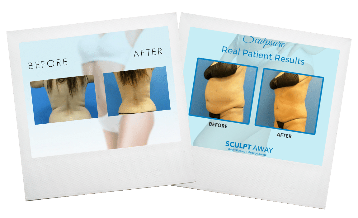 Submitted by Sculpt Away Medical Spa