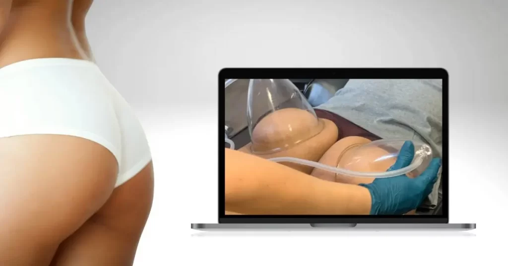 Scene from Vacuum therapy butt sculpt course on a computer screen with a woman's hips on the left side