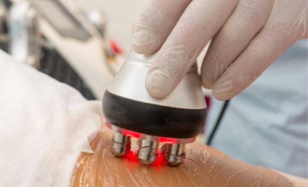 close up image of abdominal area with ultrasound gel and a 6 prong radio frequency hand piece being applied for skin tightening