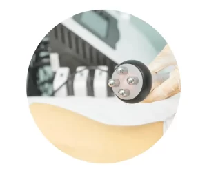 rf for body contouring